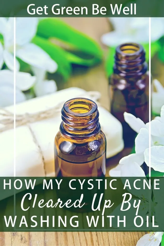 How Oil Based Cleansers Cleared Up My Cystic Acne