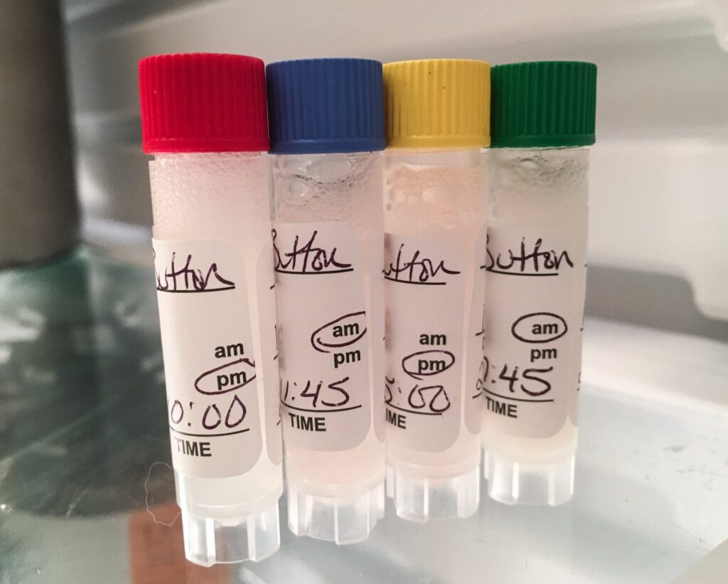 Cortisol Level Hormone Test Lab Result